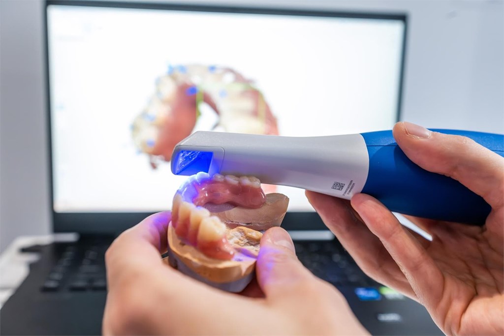 7 hábitos que podrían romper tus restauraciones dentales
