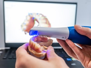 7 hábitos que podrían romper tus restauraciones dentales