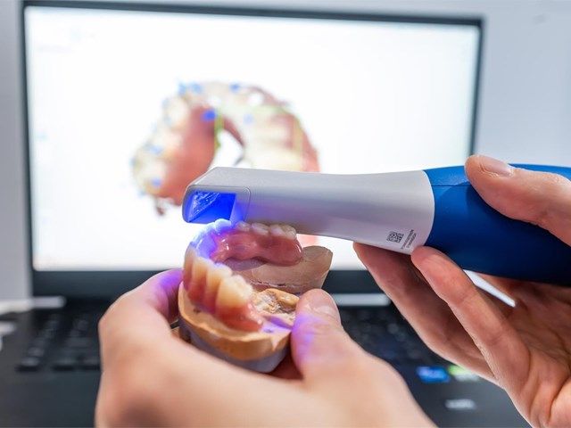 7 hábitos que podrían romper tus restauraciones dentales