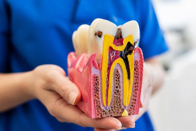 Adiós al dolor con la endodoncia en Lugo - Imagen 1