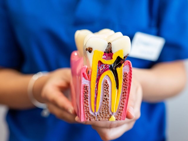 Adiós al dolor con la endodoncia en Lugo