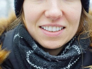 Carillas dentales: tipos y usos