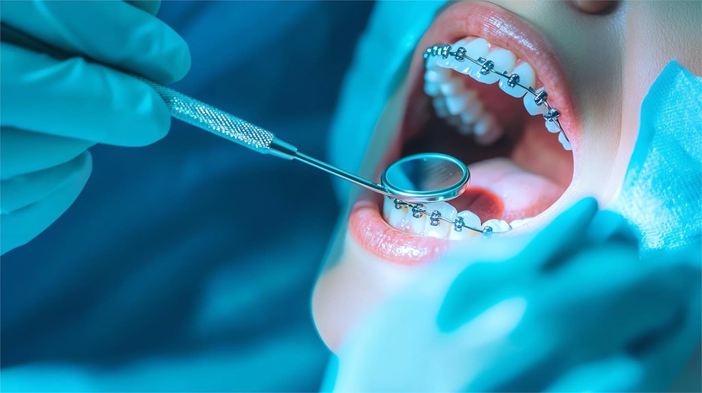 ¿Cómo evitar las llagas por el aparato?