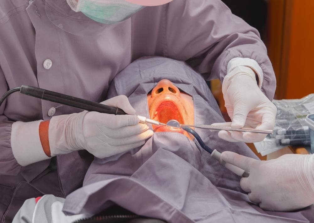 ¿Cuáles son las cirugías orales más comunes que realizamos en Magoi Dental?