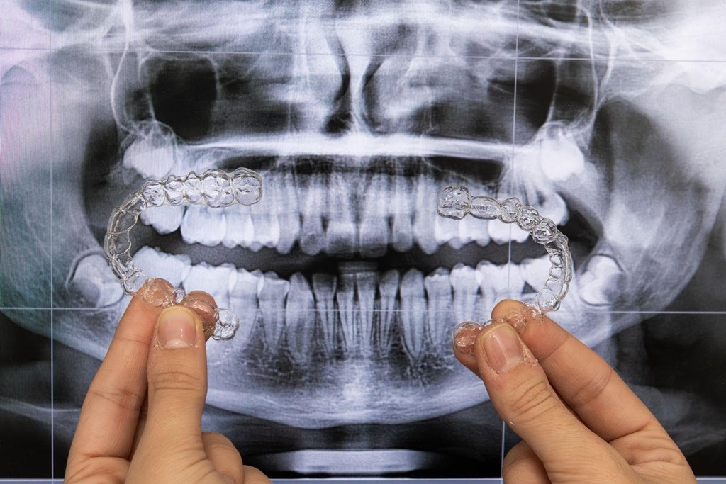¿Es la ortodoncia invisible la solución para mi sonrisa?