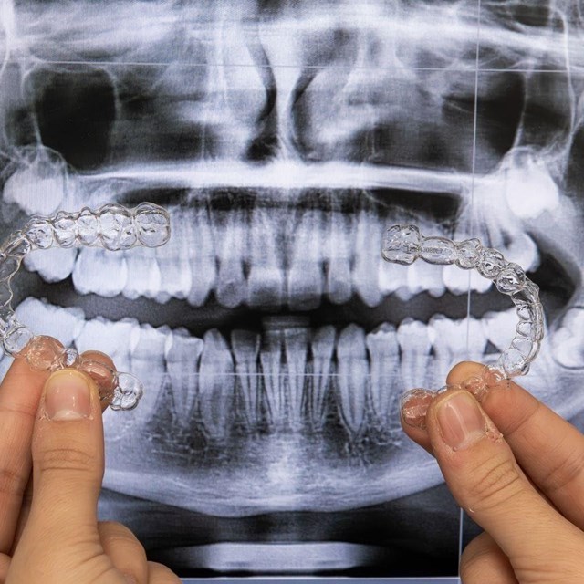 ¿Es la ortodoncia invisible la solución para mì?