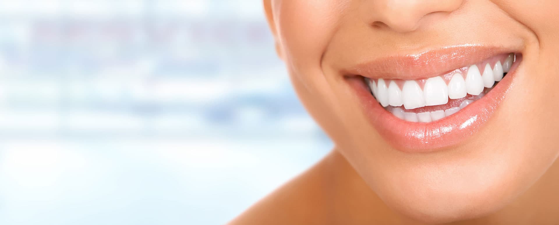 Blanqueamiento dental en Lugo