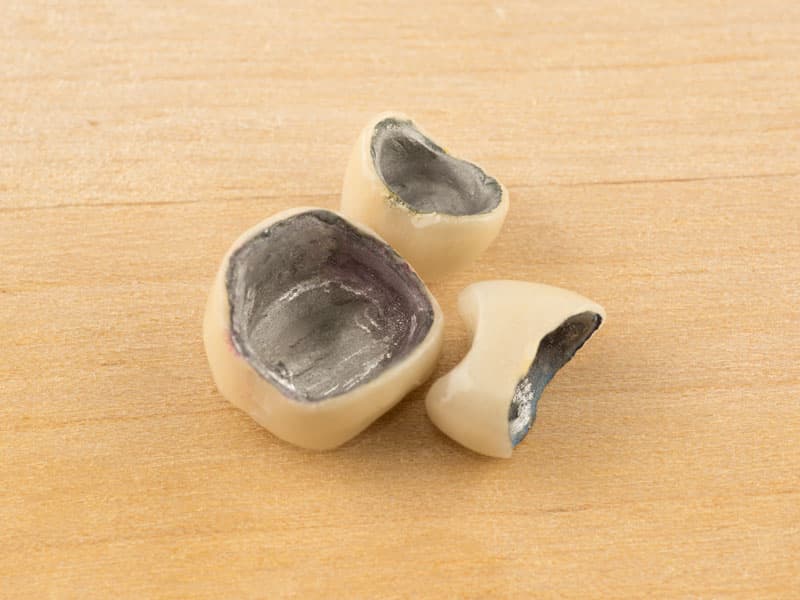 odontología restauradora en Lugo