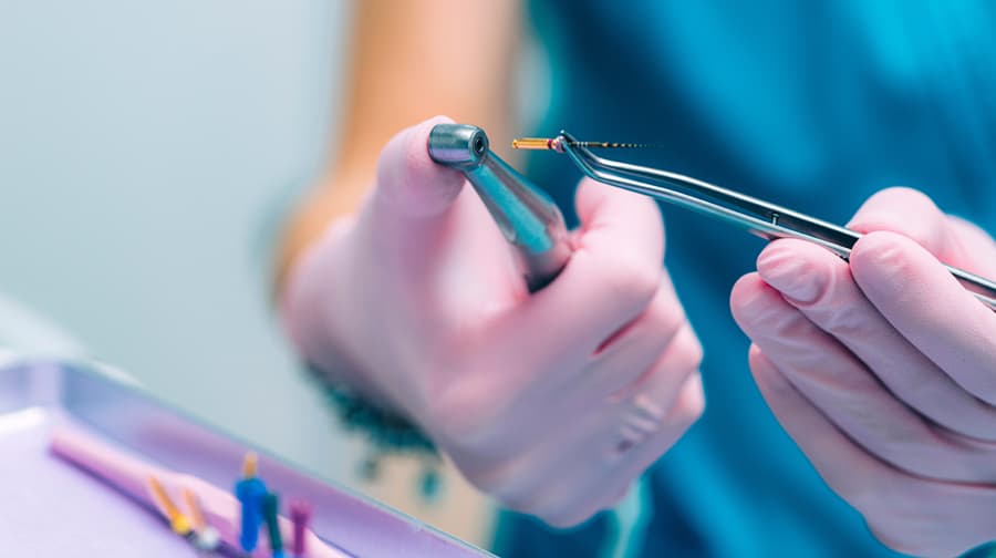 Extirpar la pulpa, endodoncia en Lugo