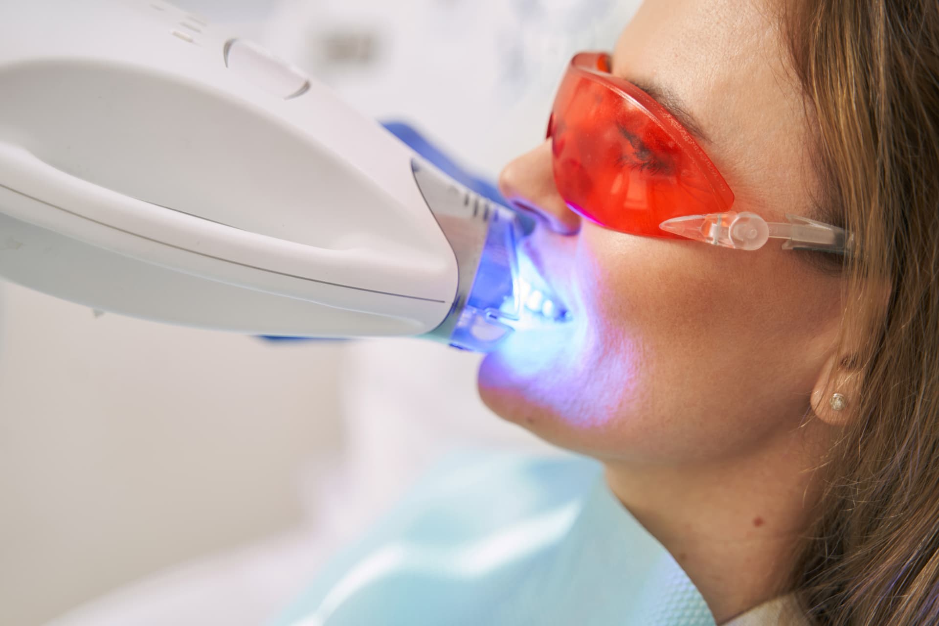 Pedir cita para hacer blanqueamiento dental en Lugo