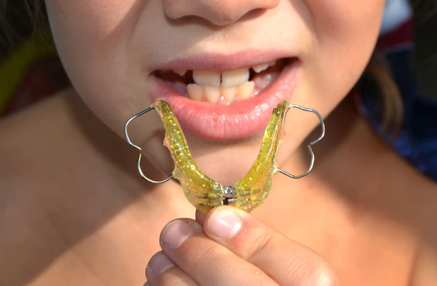 Poner aparato dental en Lugo
