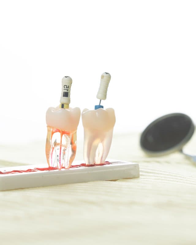 Endodoncista en Lugo