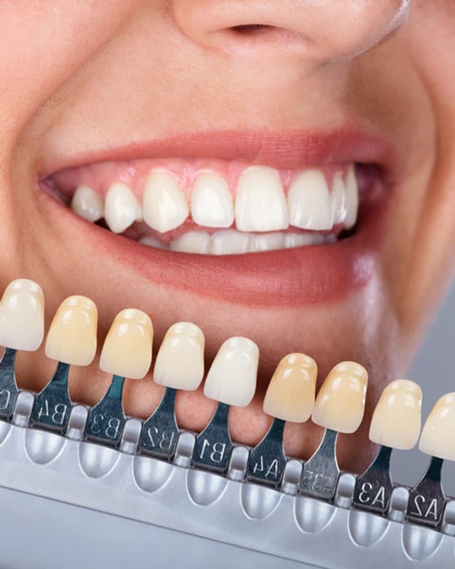 Estética dental en Lugo