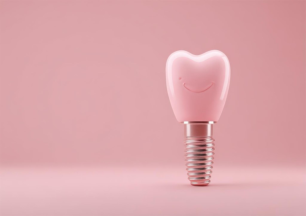 ¿Los implantes dentales son incómodos?