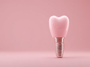 ¿Los implantes dentales son incómodos?