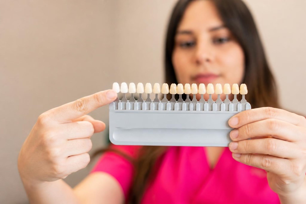 Foto 1 Luce una sonrisa más blanca con el blanqueamiento dental en Lugo