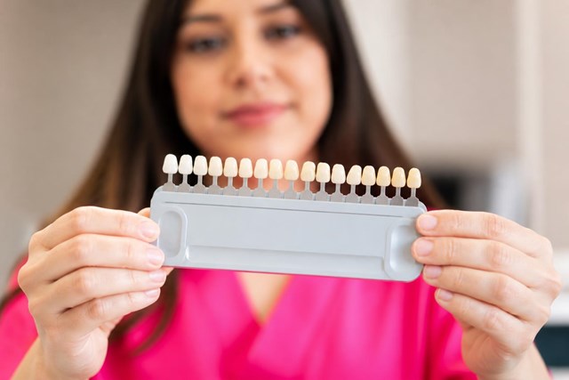 Luce una sonrisa más blanca con el blanqueamiento dental en Lugo - Imagen 1
