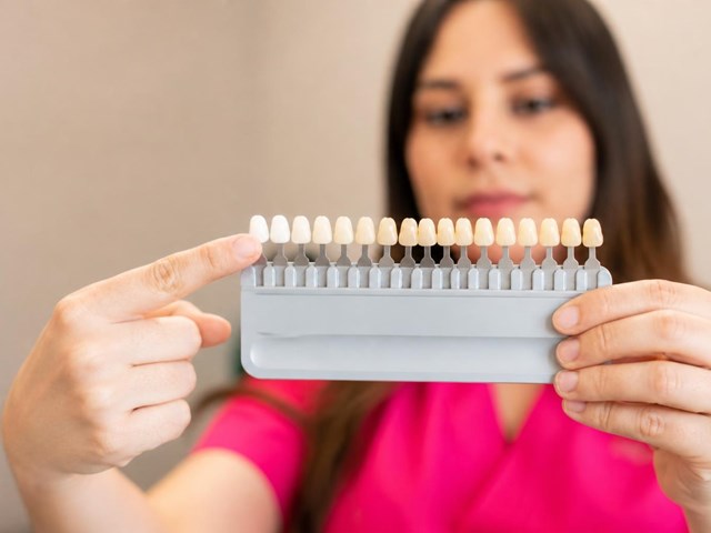 Luce una sonrisa más blanca con el blanqueamiento dental en Lugo