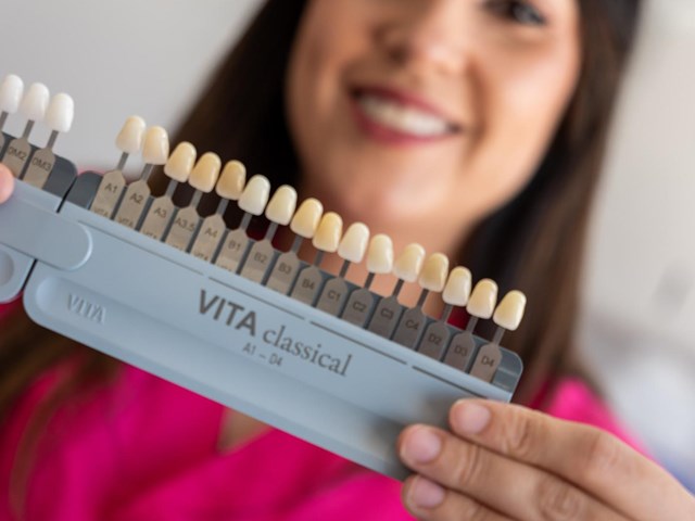 Luce una sonrisa renovada con carillas dentales en Lugo