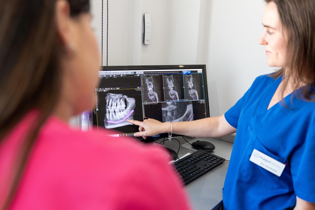Foto 1 ¿Poco hueso para un implante? Regeneración ósea dental en Lugo