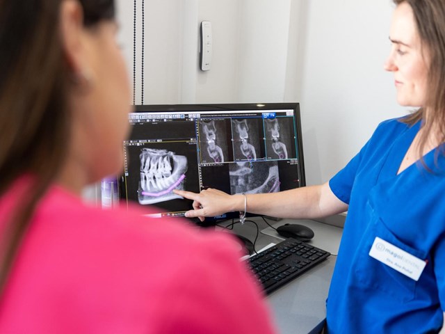 ¿Poco hueso para un implante? Regeneración ósea dental en Lugo