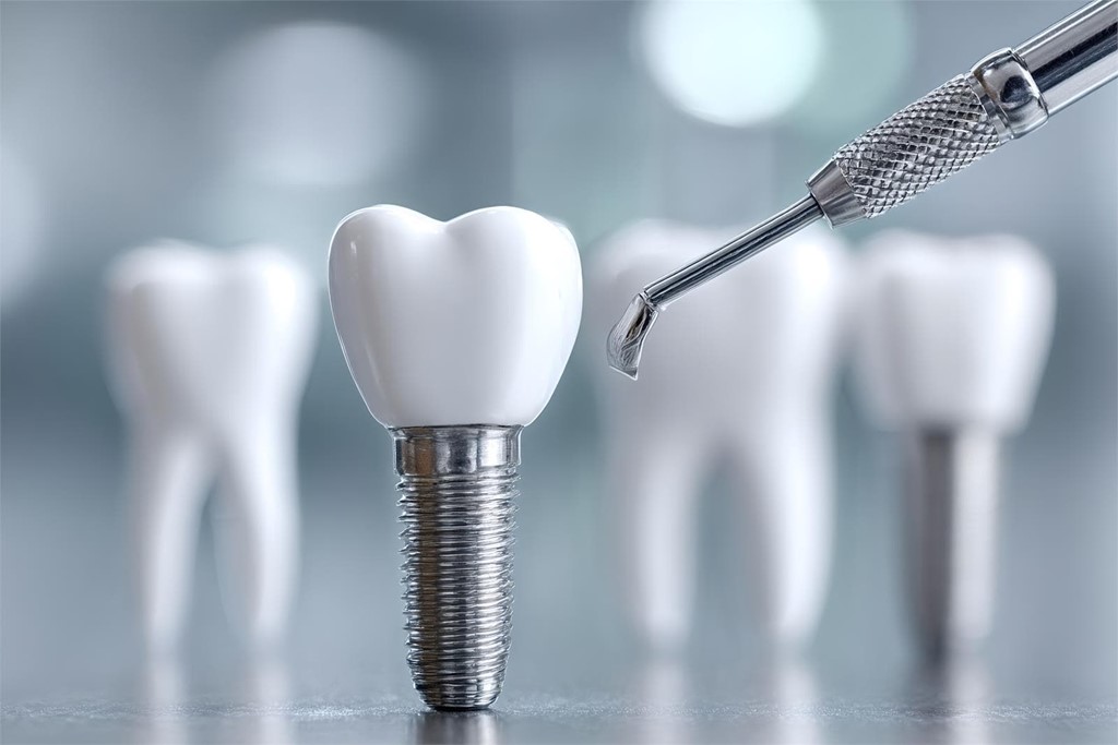 ¿Puedo comer alimentos duros si tengo implantes dentales?
