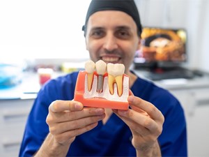 ¿Puedo ponerme implantes si tengo poco hueso?