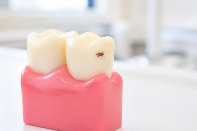 Recupera cada pieza con odontología restauradora en Lugo - Imagen 1
