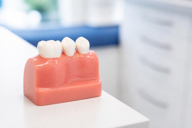 Recupera tu sonrisa con prótesis sobre implantes en Lugo - Imagen 1